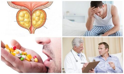 prostatitis pri moških